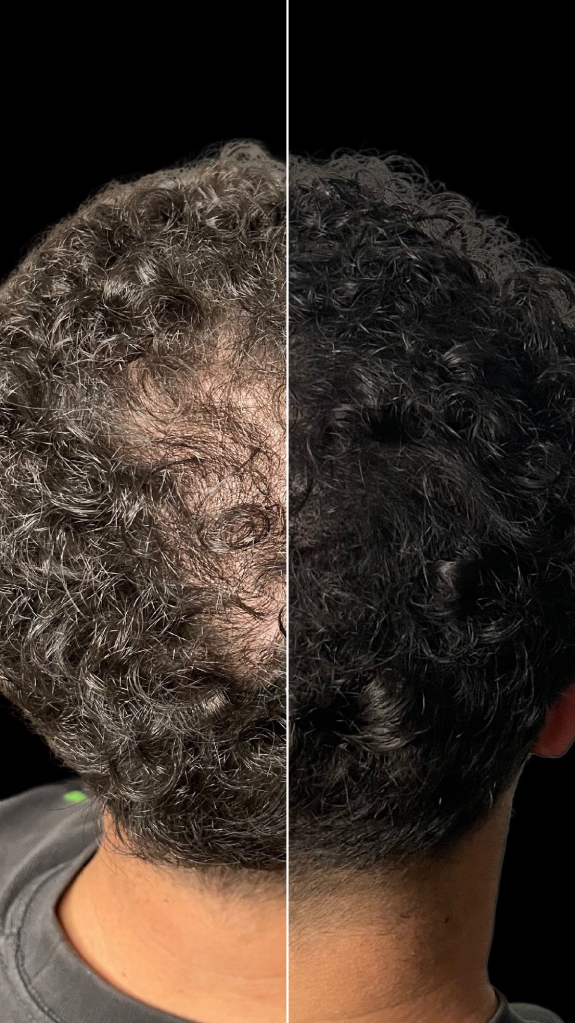 Cheveux bouclés, effet densité homme avant et après